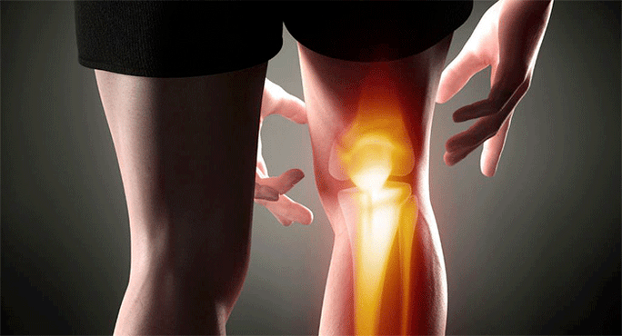 dolor en la articulación de la rodilla