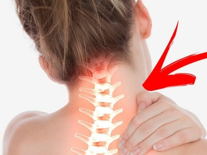 Compresión de raíces nerviosas con osteocondrosis cervical