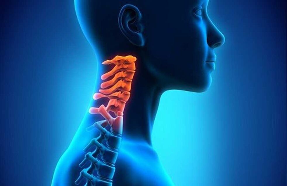 Dolor en la columna cervical.
