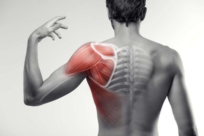 Áreas de dolor muscular.